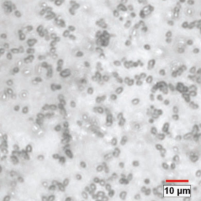 Eye drop particle size and shape
