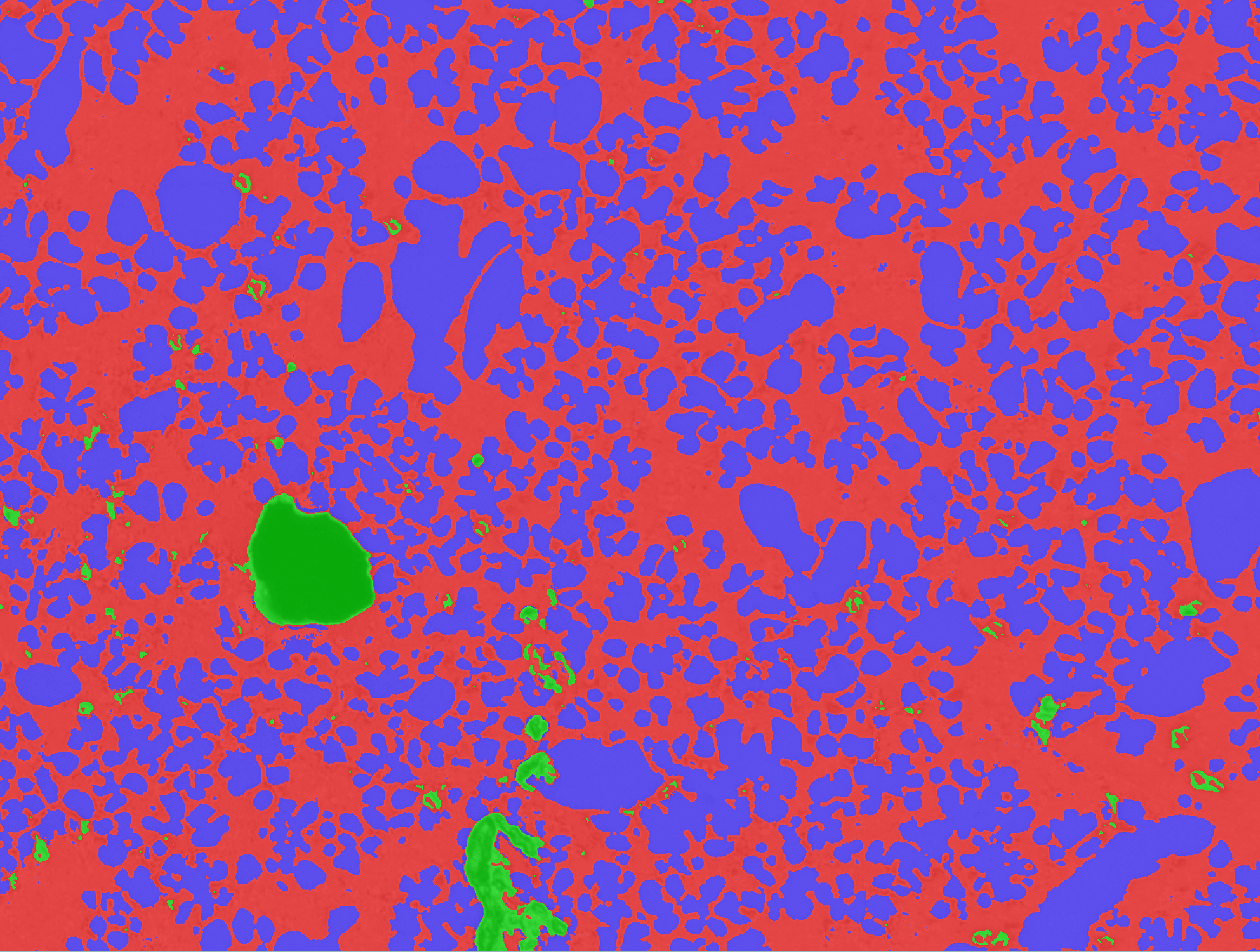 Porosity analysis in aluminum