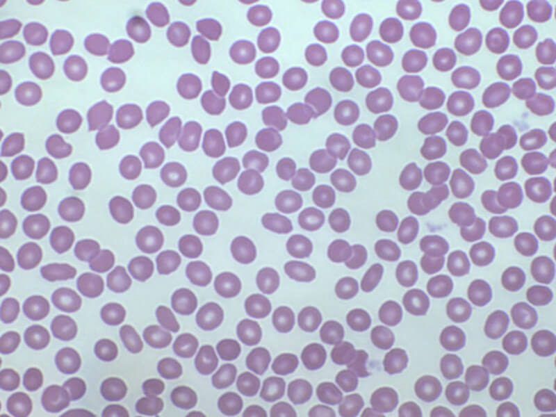 Blood cells