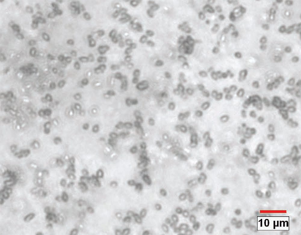 Eye drop particle size and shape