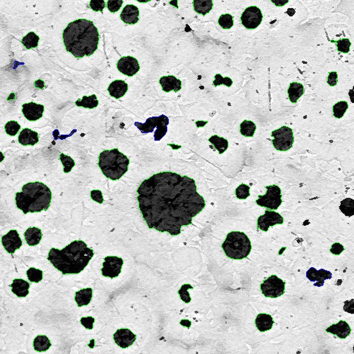 Analyse de nodularité et de ferrite-perlite