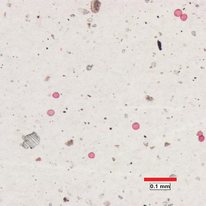 Analyse de la densité du pollen
