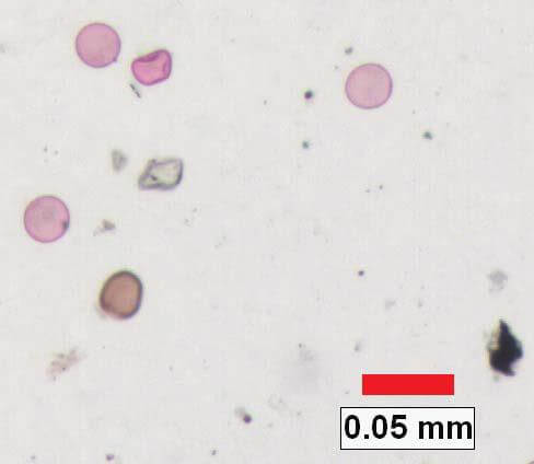 Pollen density analysis