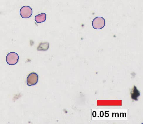 Pollen density analysis