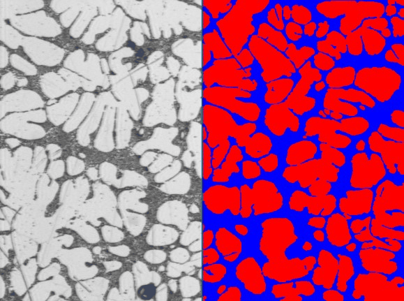 Aluminum alloy 357 dendrite structure shown as the original micrograph and its binarized eutectic and alpha aluminum phases