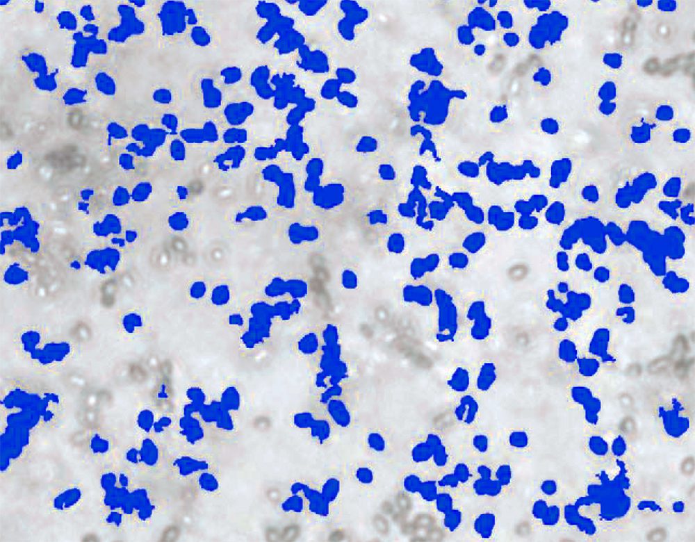 Eye drop particle size and shape